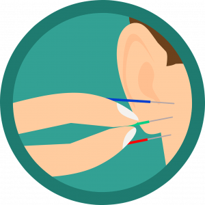 auriculotherapie: acupuncture sur l'oreille
